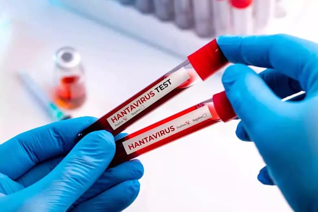 Hantavírus acende alerta global, mas cenário no Brasil é diferente
